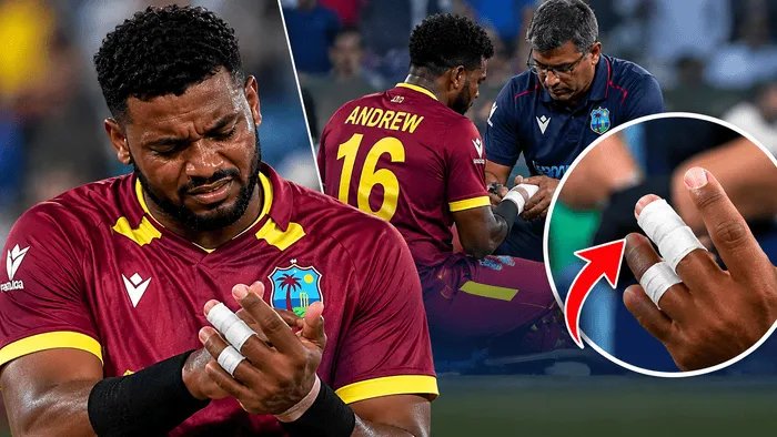 Jewel Andrew receives treatment for his finger injury ahead of West Indies T20I series
